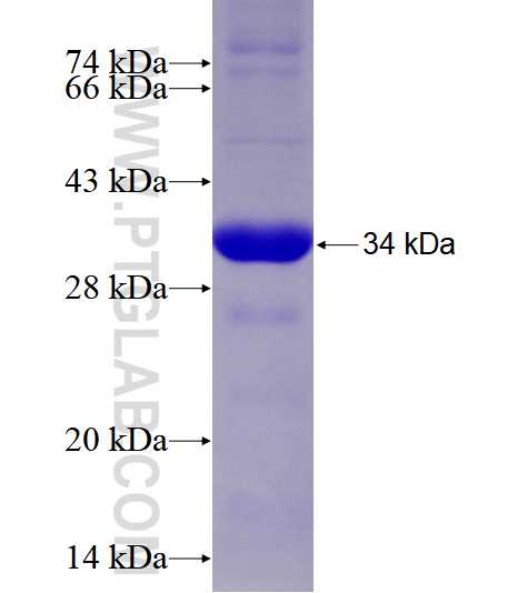 Calnexin fusion protein Ag25535 SDS-PAGE