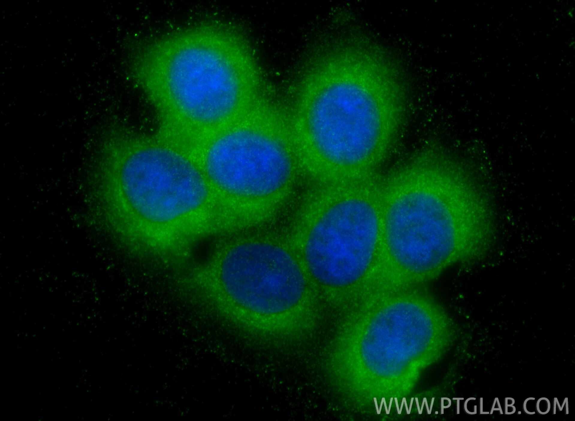 Immunofluorescence (IF) / fluorescent staining of MCF-7 cells using Calpain 15/SOLH Polyclonal antibody (33924-1-AP)