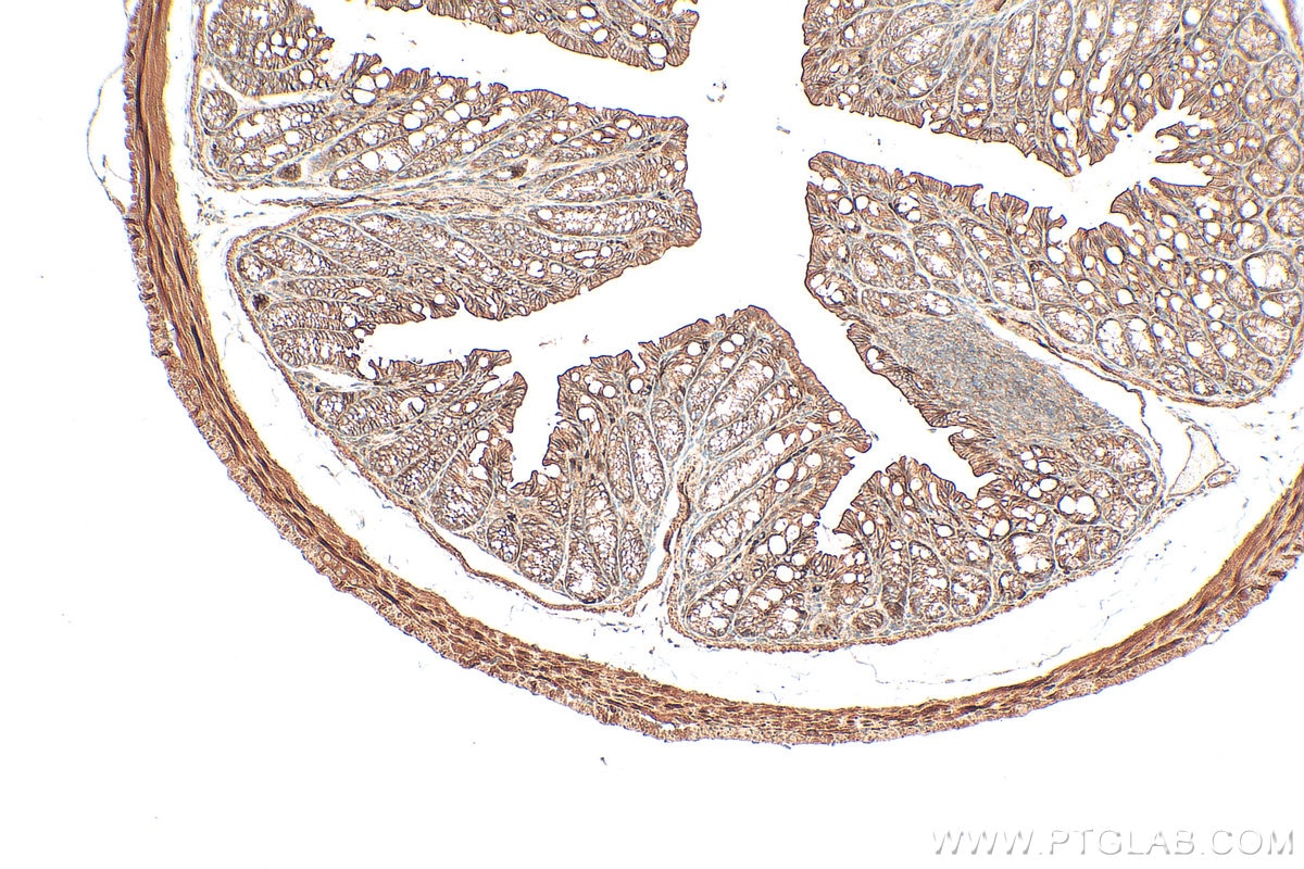 IHC staining of mouse colon using 33924-1-AP (same clone as 33924-1-PBS) Immunohistochemistry (IHC) staining of mouse colon tissue using Calpain 15/SOLH Polyclonal antibody (33924-1-AP)