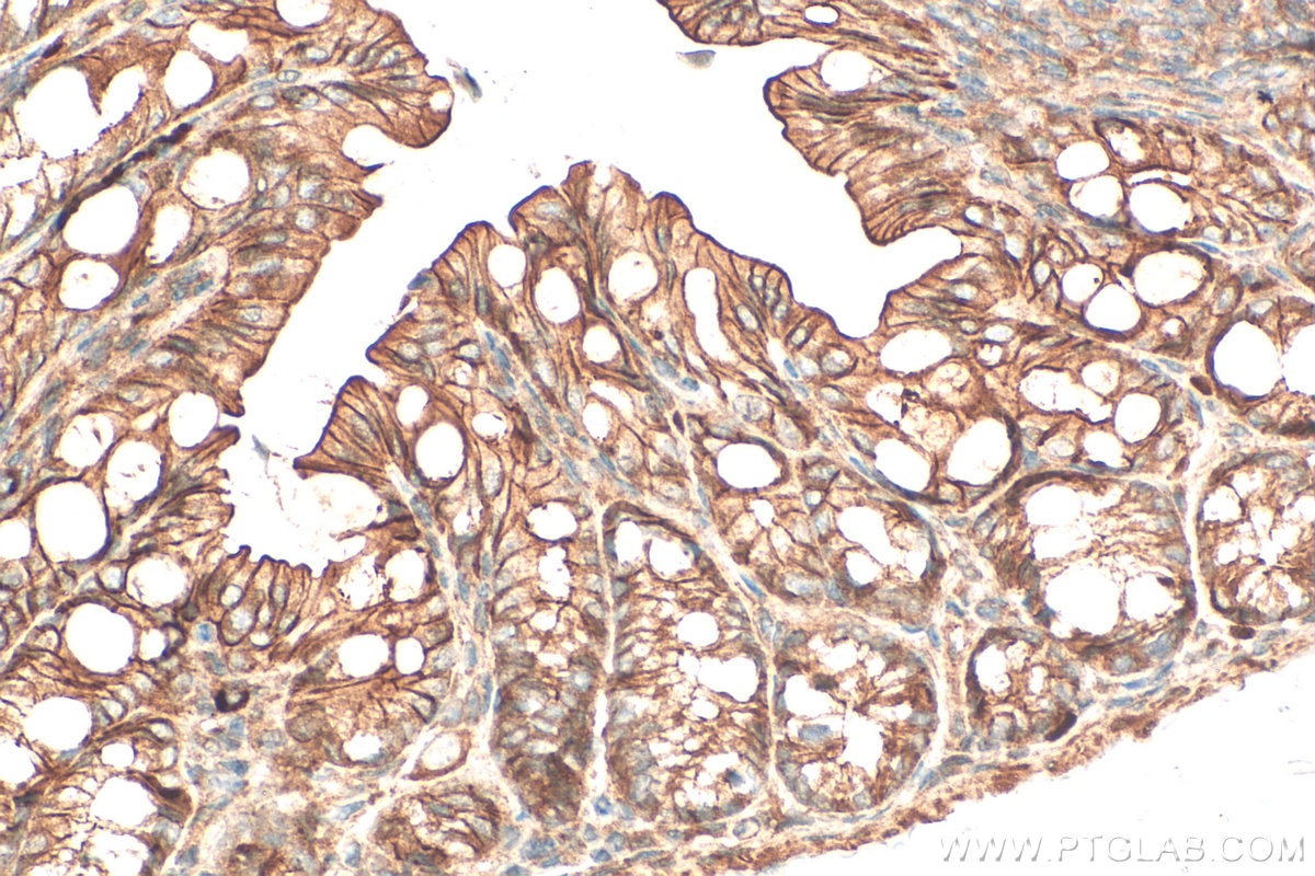 IHC staining of mouse colon using 33924-1-AP (same clone as 33924-1-PBS) Immunohistochemistry (IHC) staining of mouse colon tissue using Calpain 15/SOLH Polyclonal antibody (33924-1-AP)