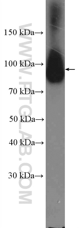 Western Blot (WB) analysis of HeLa cells using Calpain 7 Polyclonal antibody (26985-1-AP)