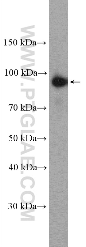 Western Blot (WB) analysis of mouse brain tissue using Calpain 7 Polyclonal antibody (26985-1-AP)