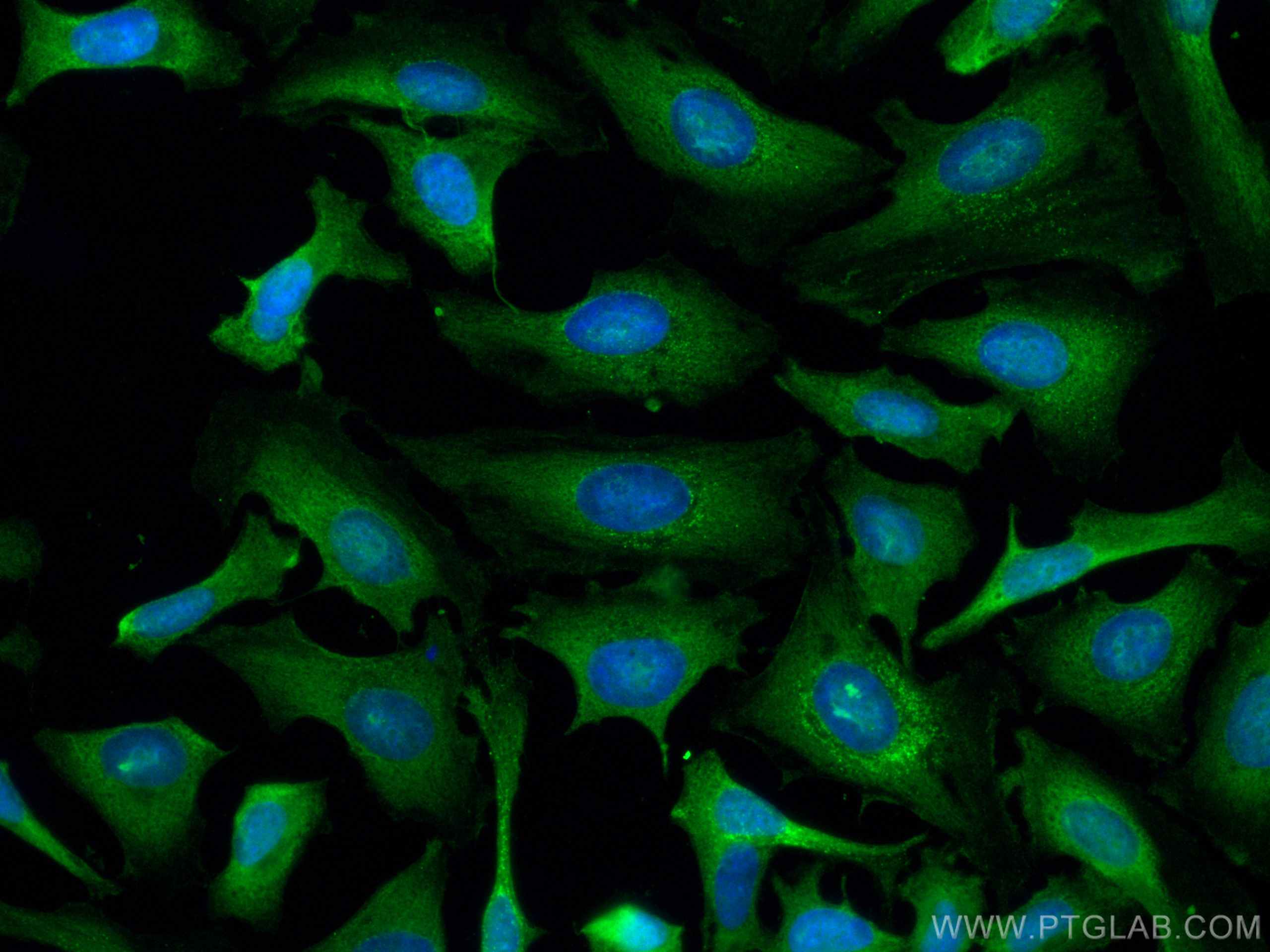 Immunofluorescence (IF) / fluorescent staining of HeLa cells using CoraLite® Plus 488-conjugated Calpastatin Monoclon (CL488-67107)