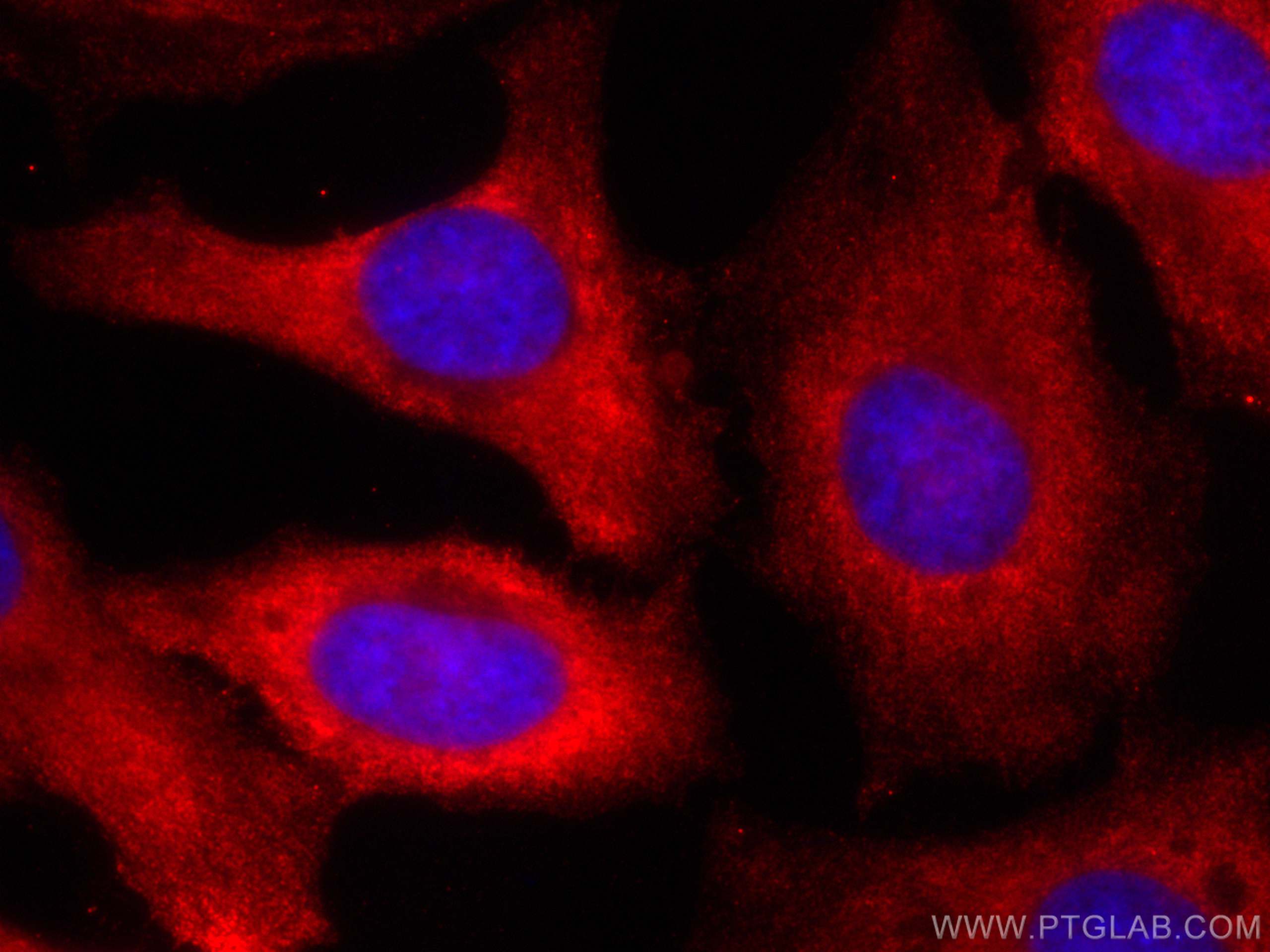 Immunofluorescence (IF) / fluorescent staining of HeLa cells using CoraLite®594-conjugated Calpastatin Monoclonal ant (CL594-67107)