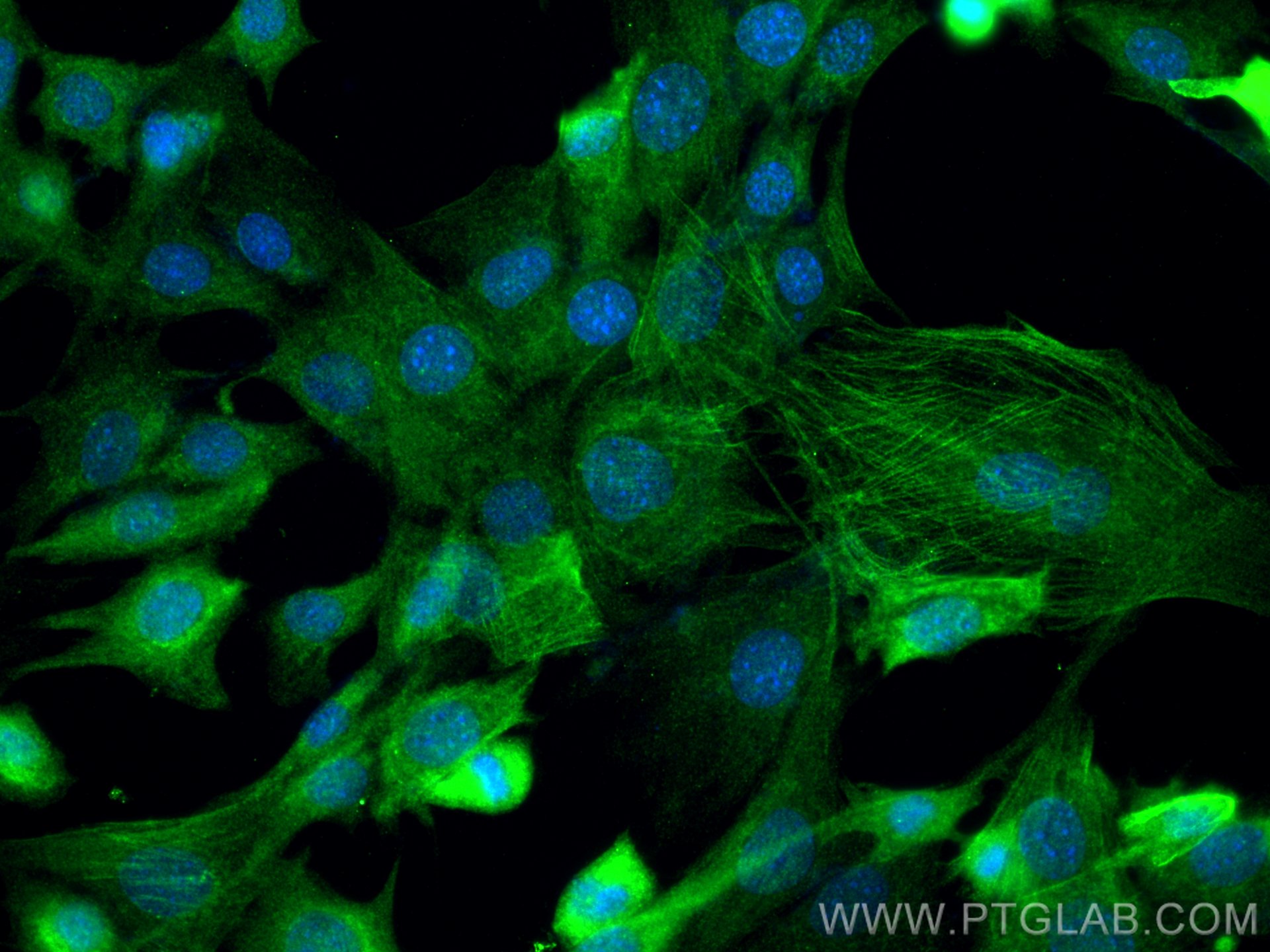 Immunofluorescence (IF) / fluorescent staining of C2C12 cells using Calponin Polyclonal antibody (24855-1-AP)