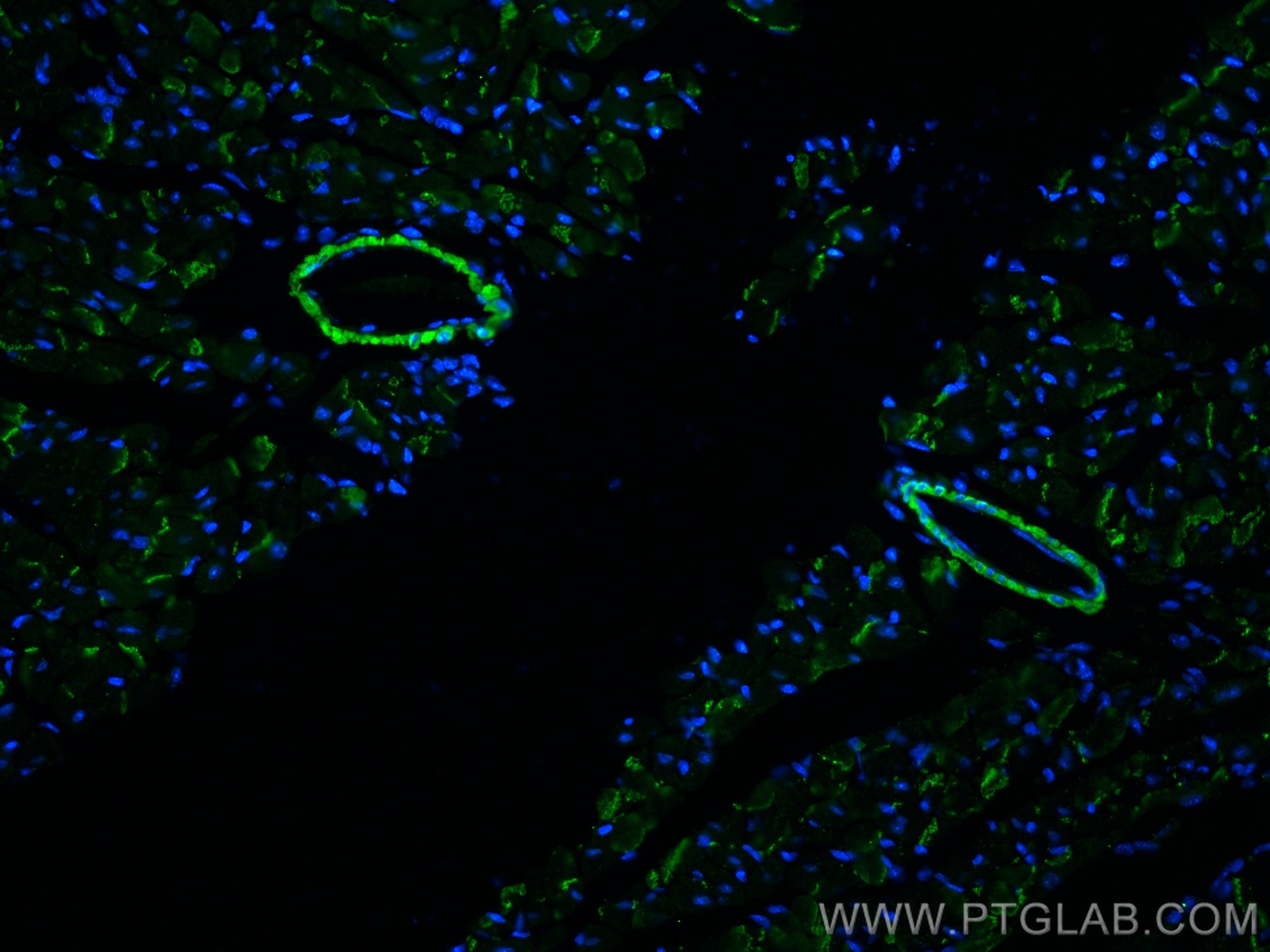 Immunofluorescence (IF) / fluorescent staining of mouse heart tissue using Calponin Polyclonal antibody (24855-1-AP)