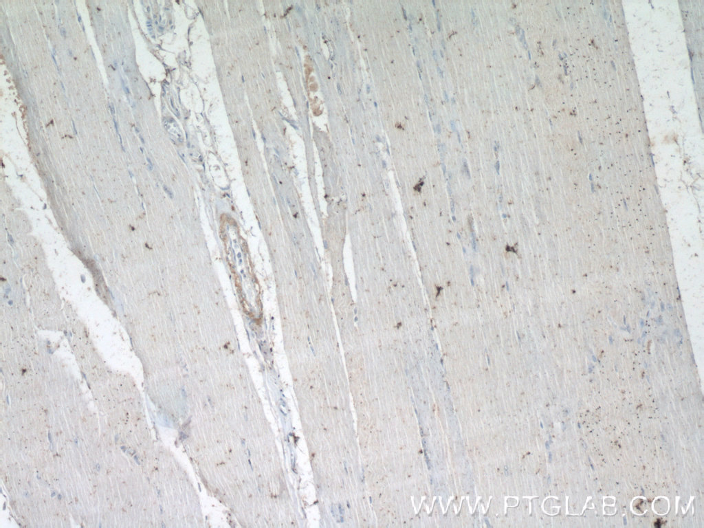 IHC staining of human skeletal muscle using 24855-1-AP