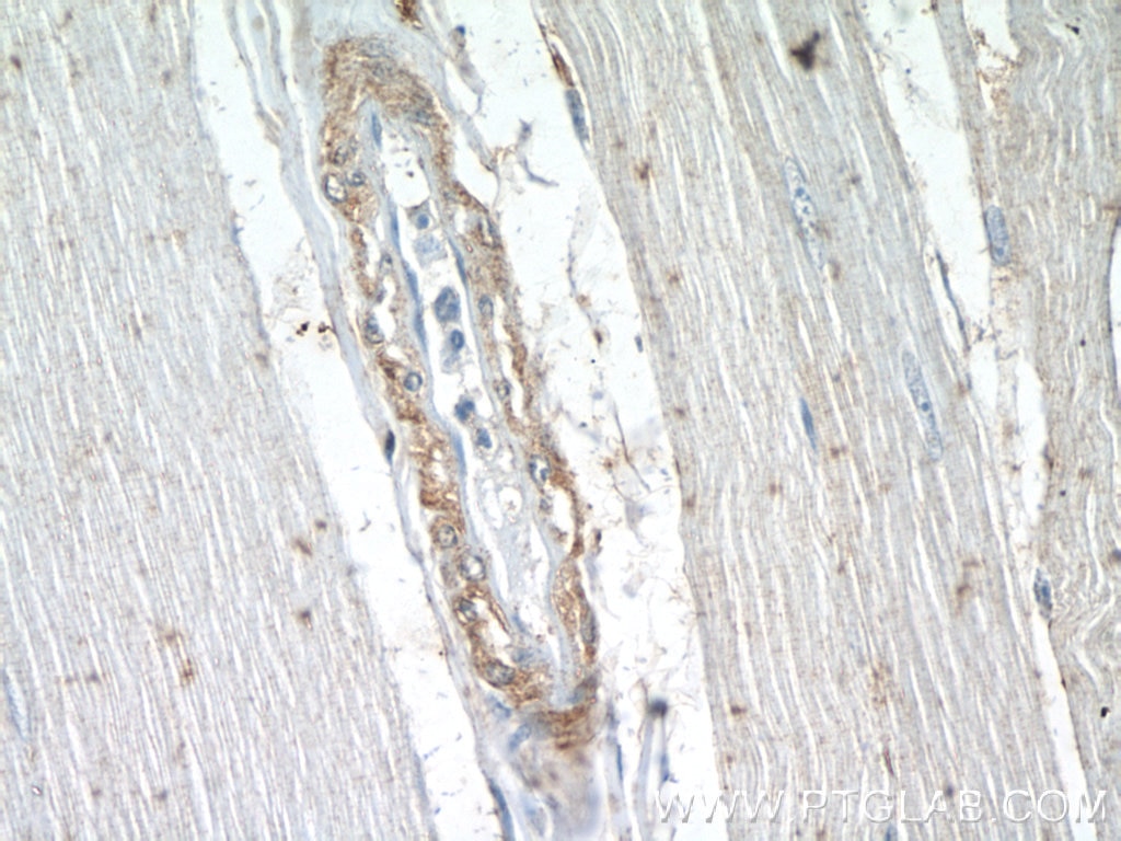 Immunohistochemistry (IHC) staining of human skeletal muscle tissue using Calponin Polyclonal antibody (24855-1-AP)