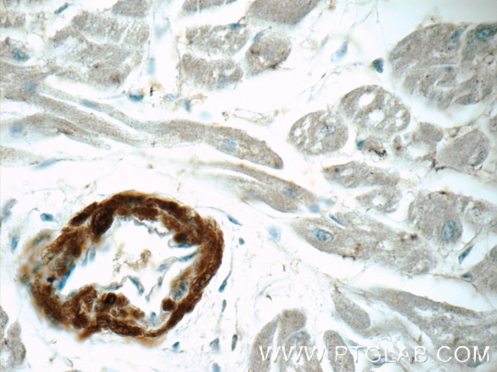 Immunohistochemistry (IHC) staining of human heart tissue using Calponin Polyclonal antibody (24855-1-AP)