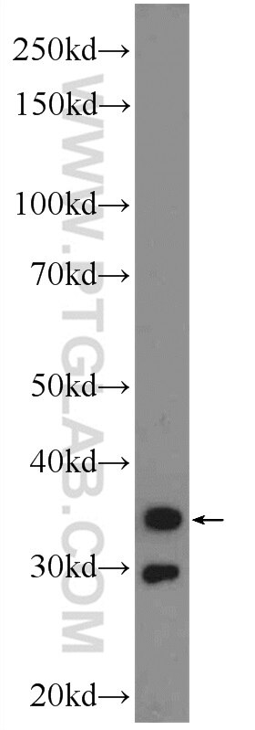 Western Blot (WB) analysis of mouse stomach tissue using Calponin Polyclonal antibody (24855-1-AP)