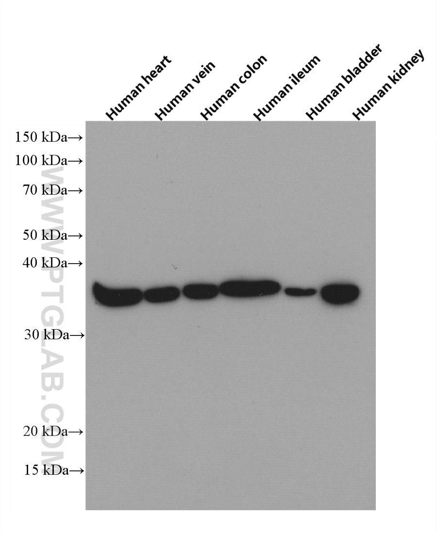 Western Blot (WB) analysis of various lysates using Calponin Monoclonal antibody (66540-1-Ig)