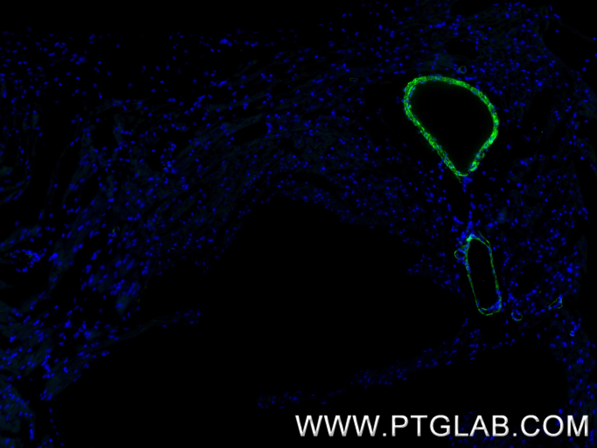 Immunofluorescence (IF) / fluorescent staining of mouse heart tissue using Calponin Recombinant monoclonal antibody (86977-4-RR)