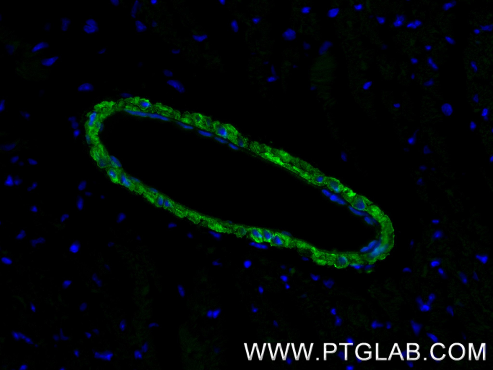 Immunofluorescence (IF) / fluorescent staining of mouse heart tissue using Calponin Recombinant monoclonal antibody (86977-4-RR)