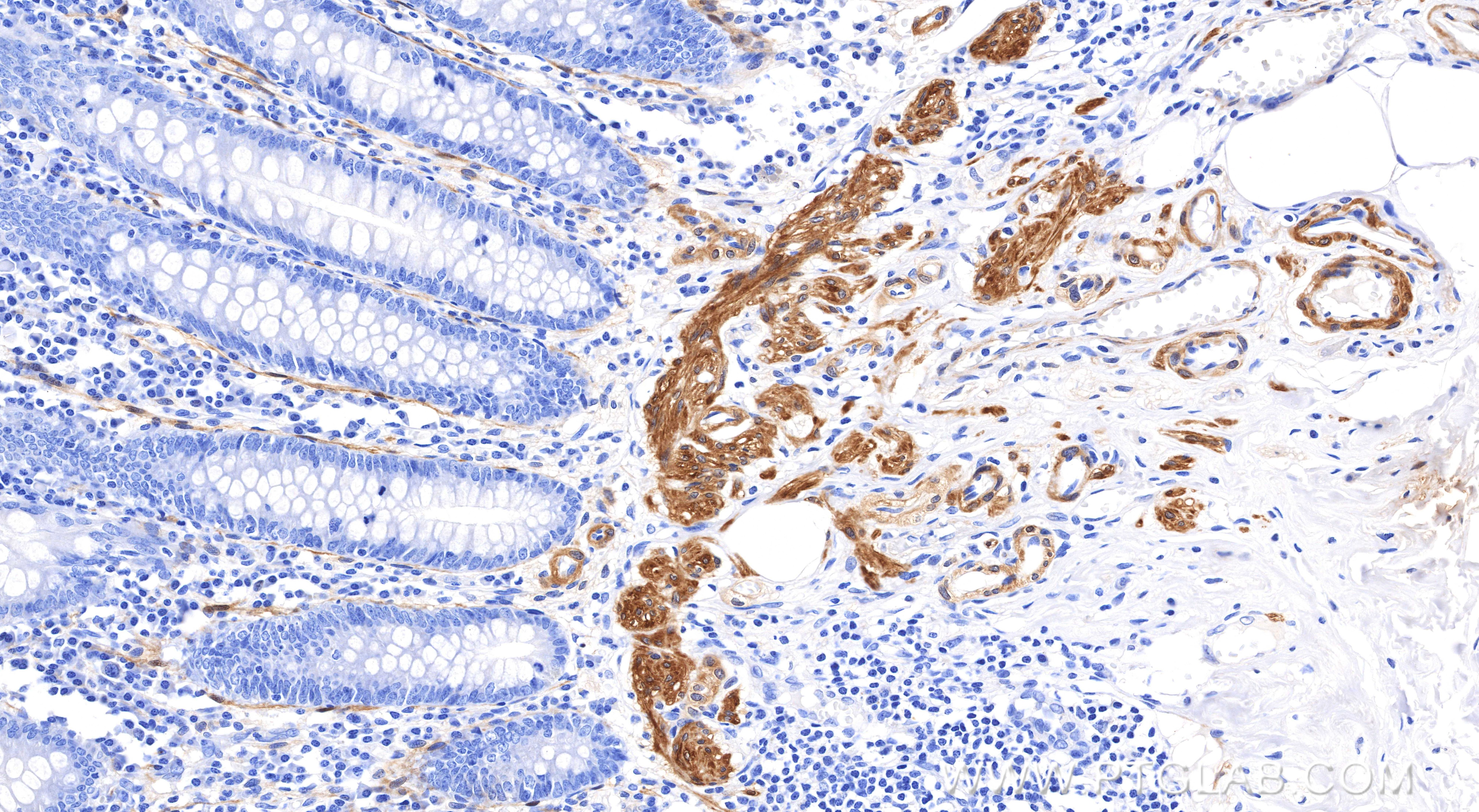 Immunohistochemistry (IHC) staining of human appendix tissue using Calponin Recombinant monoclonal antibody (86977-4-RR)
