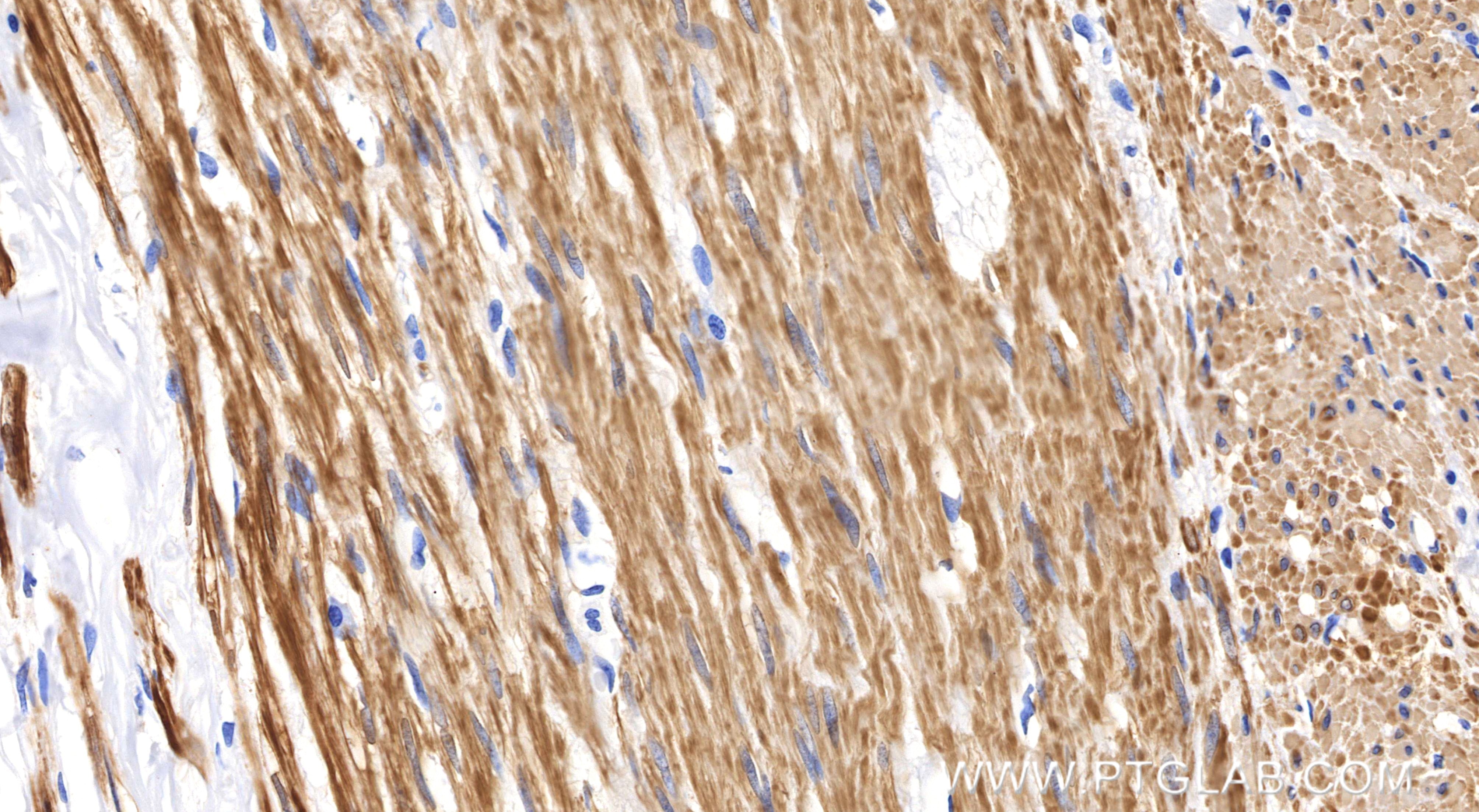 Immunohistochemistry (IHC) staining of human appendix tissue using Calponin Recombinant monoclonal antibody (86977-4-RR)