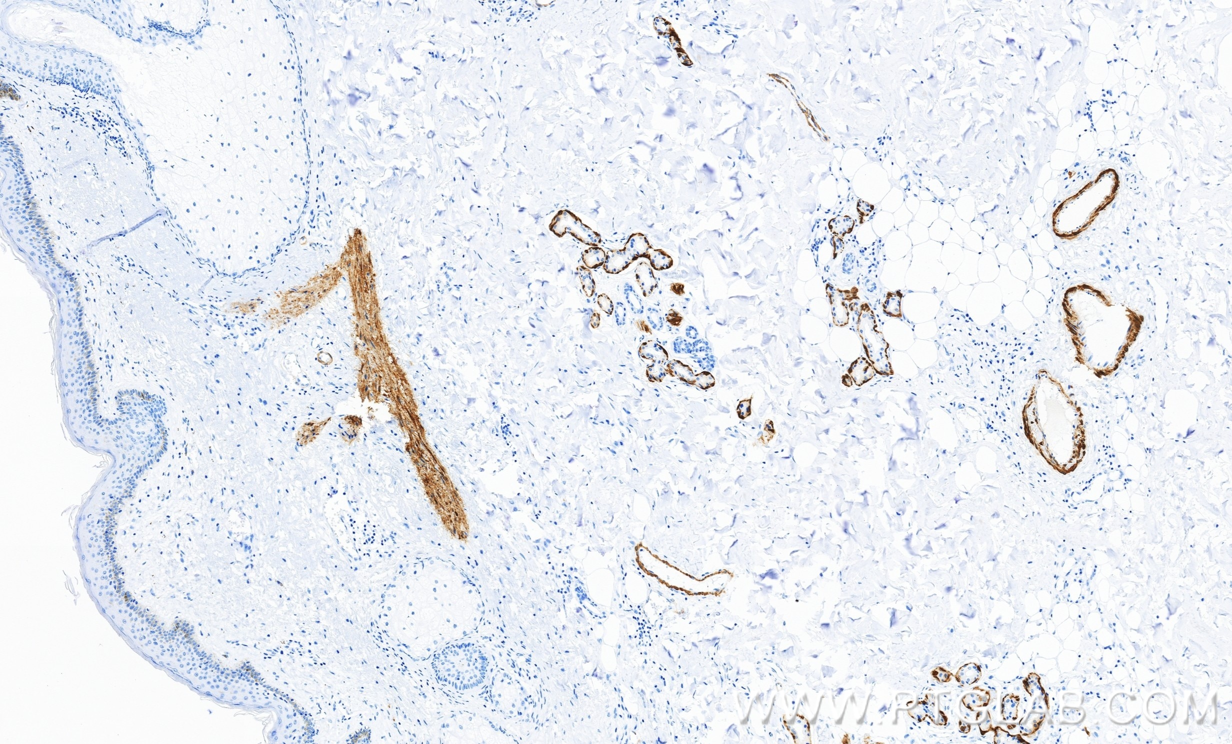 Immunohistochemistry (IHC) staining of human skin tissue using Calponin Recombinant monoclonal antibody (86977-4-RR)