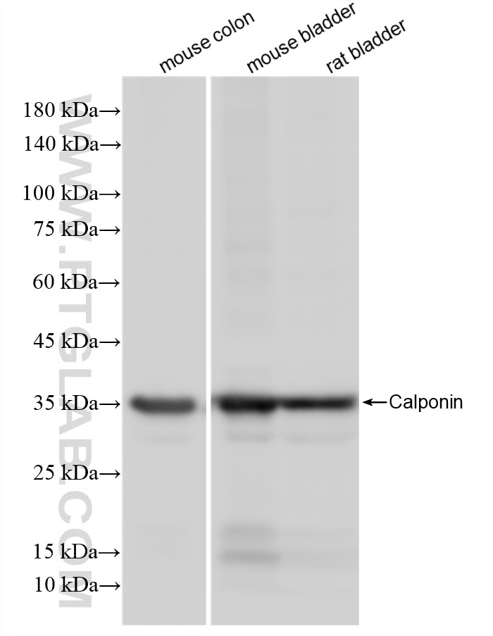 Western Blot (WB) analysis of various lysates using Calponin Recombinant monoclonal antibody (86977-4-RR)