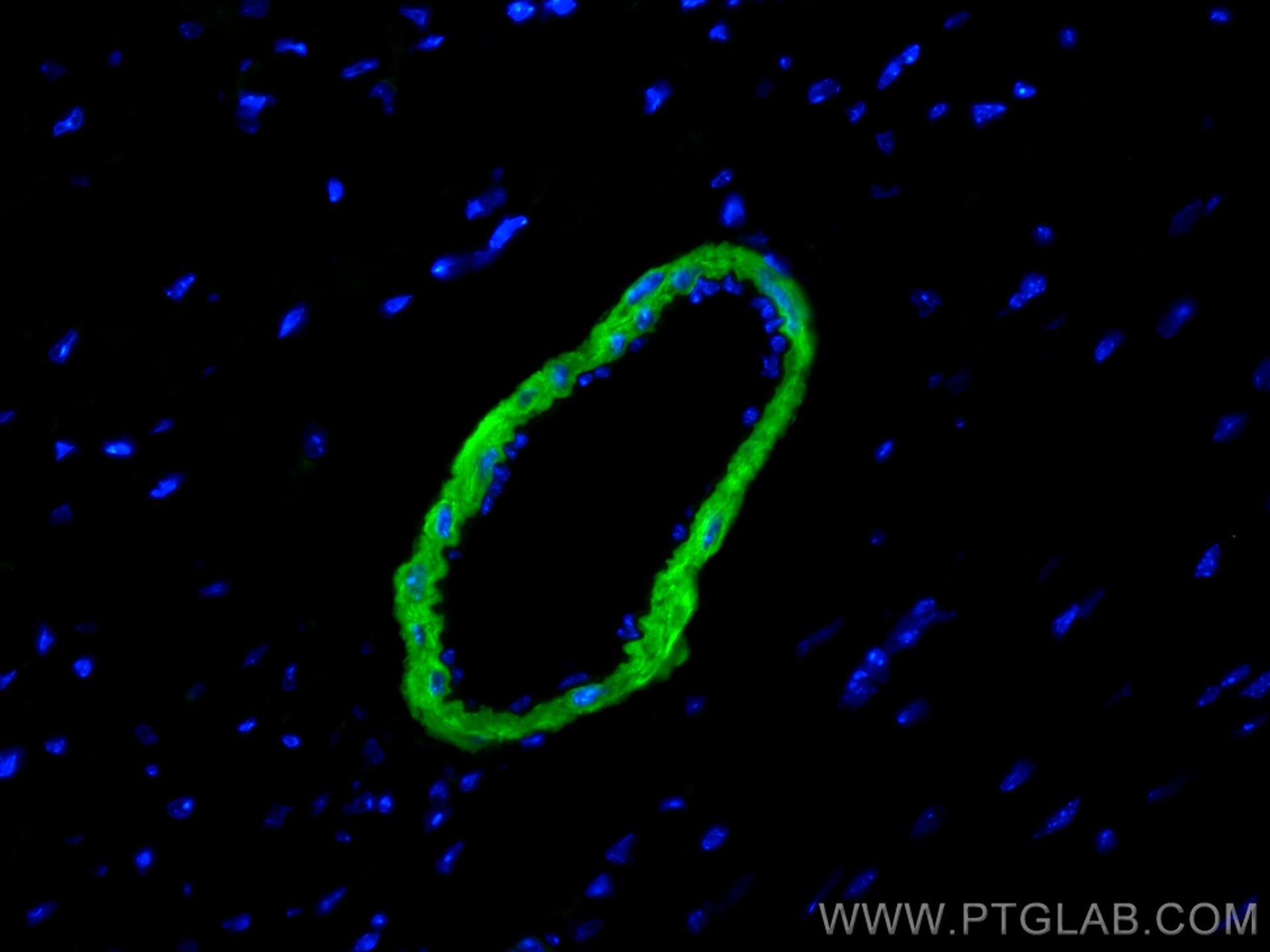 Immunofluorescence (IF) / fluorescent staining of mouse heart tissue using CoraLite® Plus 488-conjugated Calponin Polyclonal  (CL488-13938)