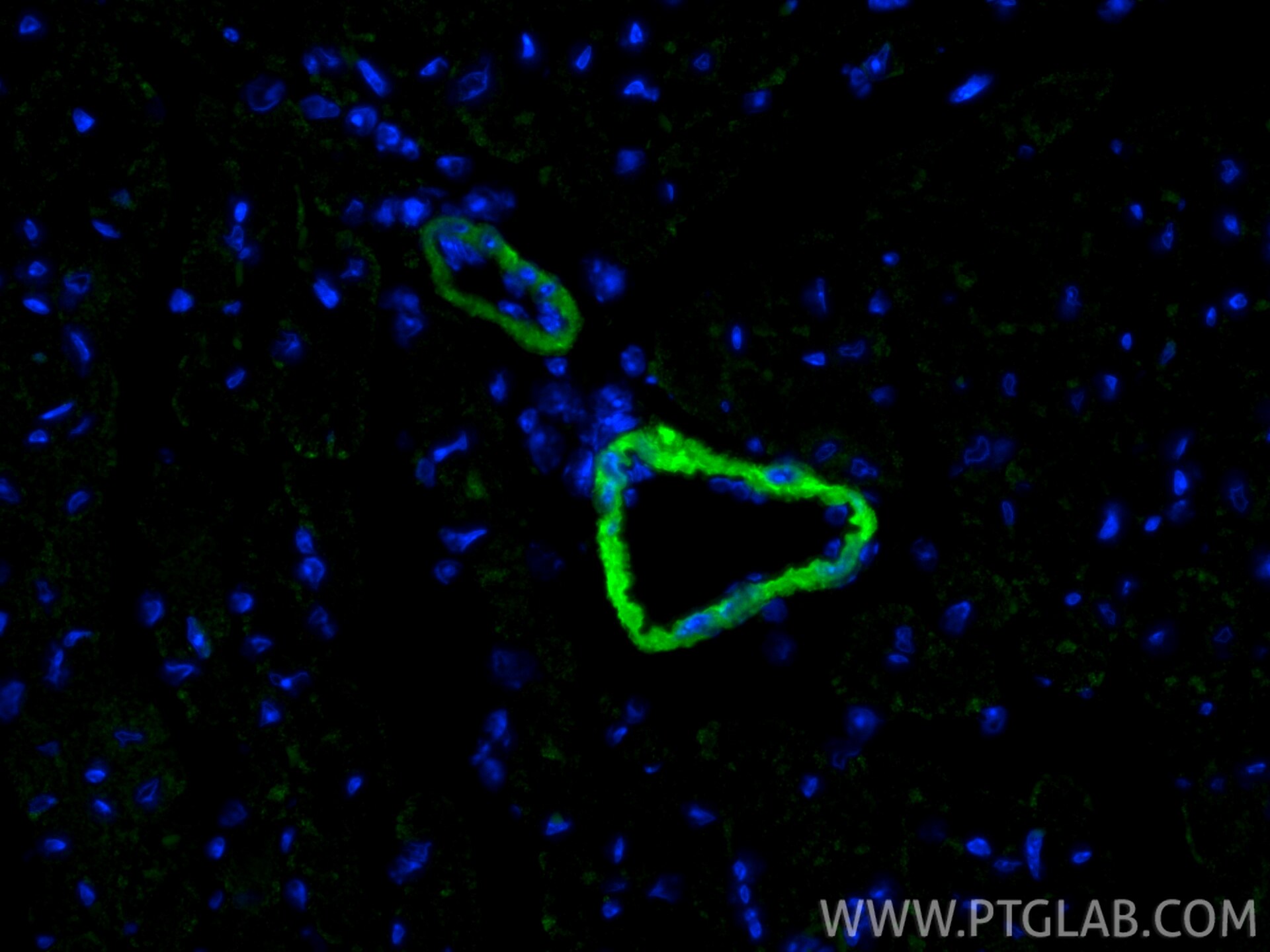 IF Staining of mouse heart using CL488-86977-4 Immunofluorescence (IF) / fluorescent staining of mouse heart tissue using CoraLite® Plus 488-conjugated Calponin Recombinant (CL488-86977-4)