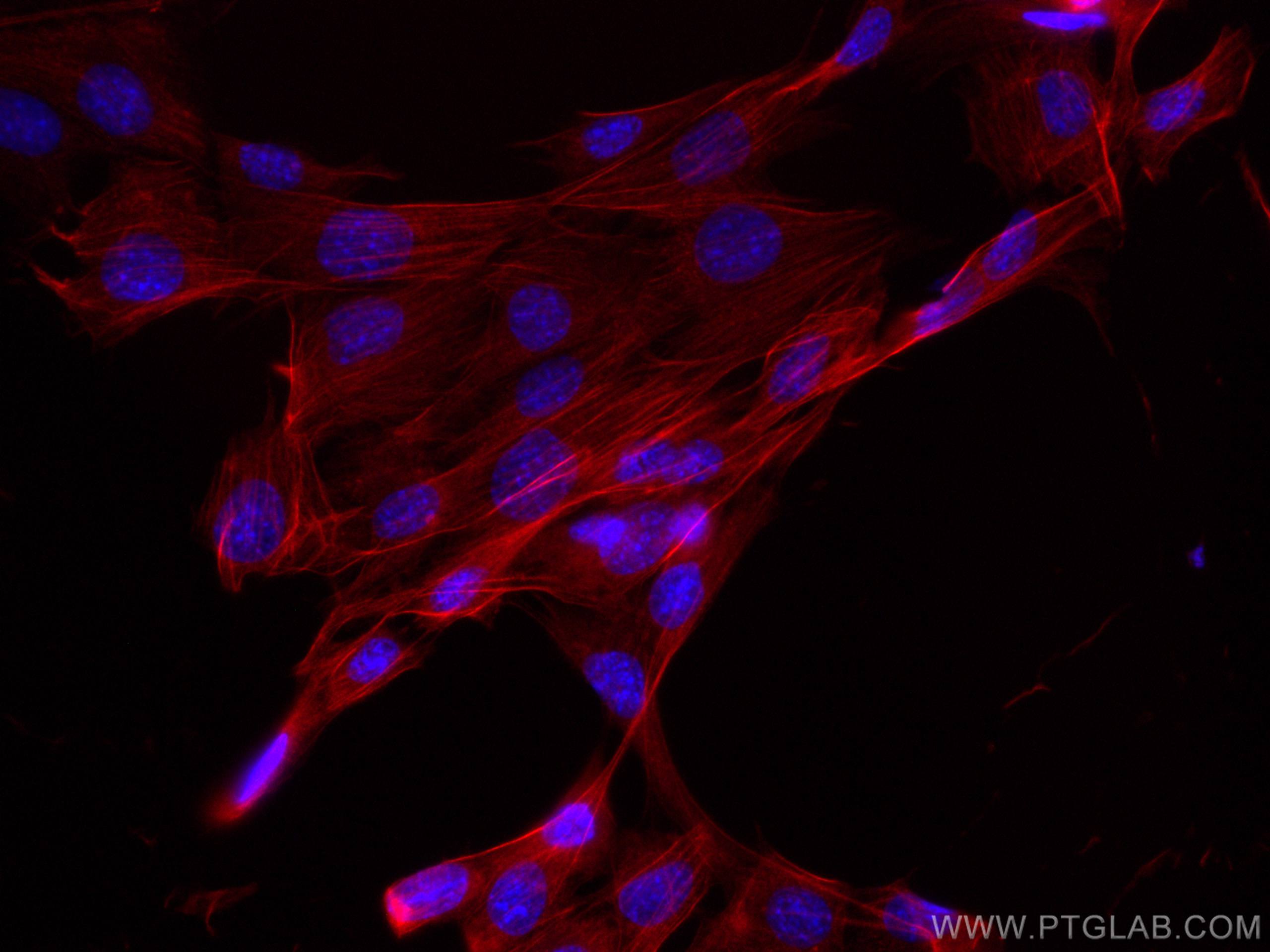 Immunofluorescence (IF) / fluorescent staining of C2C12 cells using CoraLite®594-conjugated Calponin Polyclonal antibo (CL594-13938)