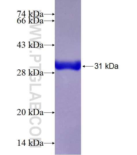 Calponin fusion protein Ag21384 SDS-PAGE