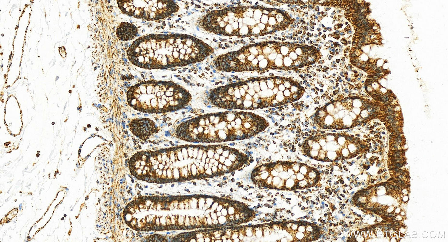 Immunohistochemistry (IHC) staining of human colon tissue using calreticulin Polyclonal antibody (27298-1-AP)
