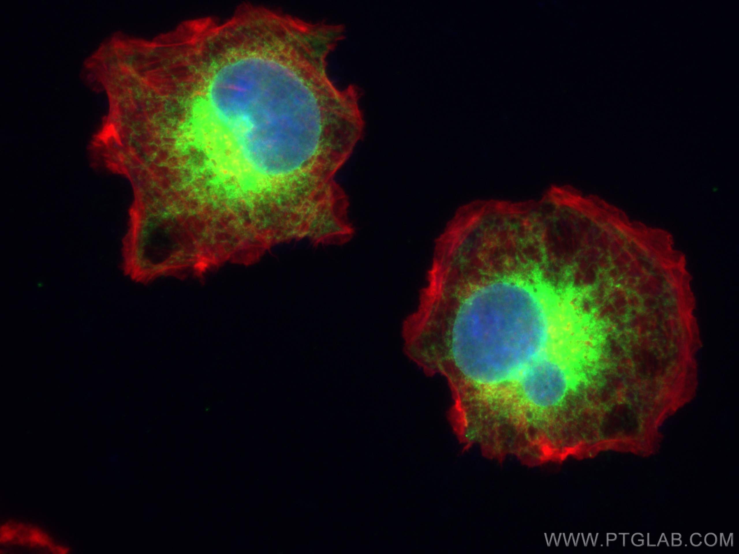 Immunofluorescence (IF) / fluorescent staining of SKOV-3 cells using calreticulin Polyclonal antibody (27298-1-AP)