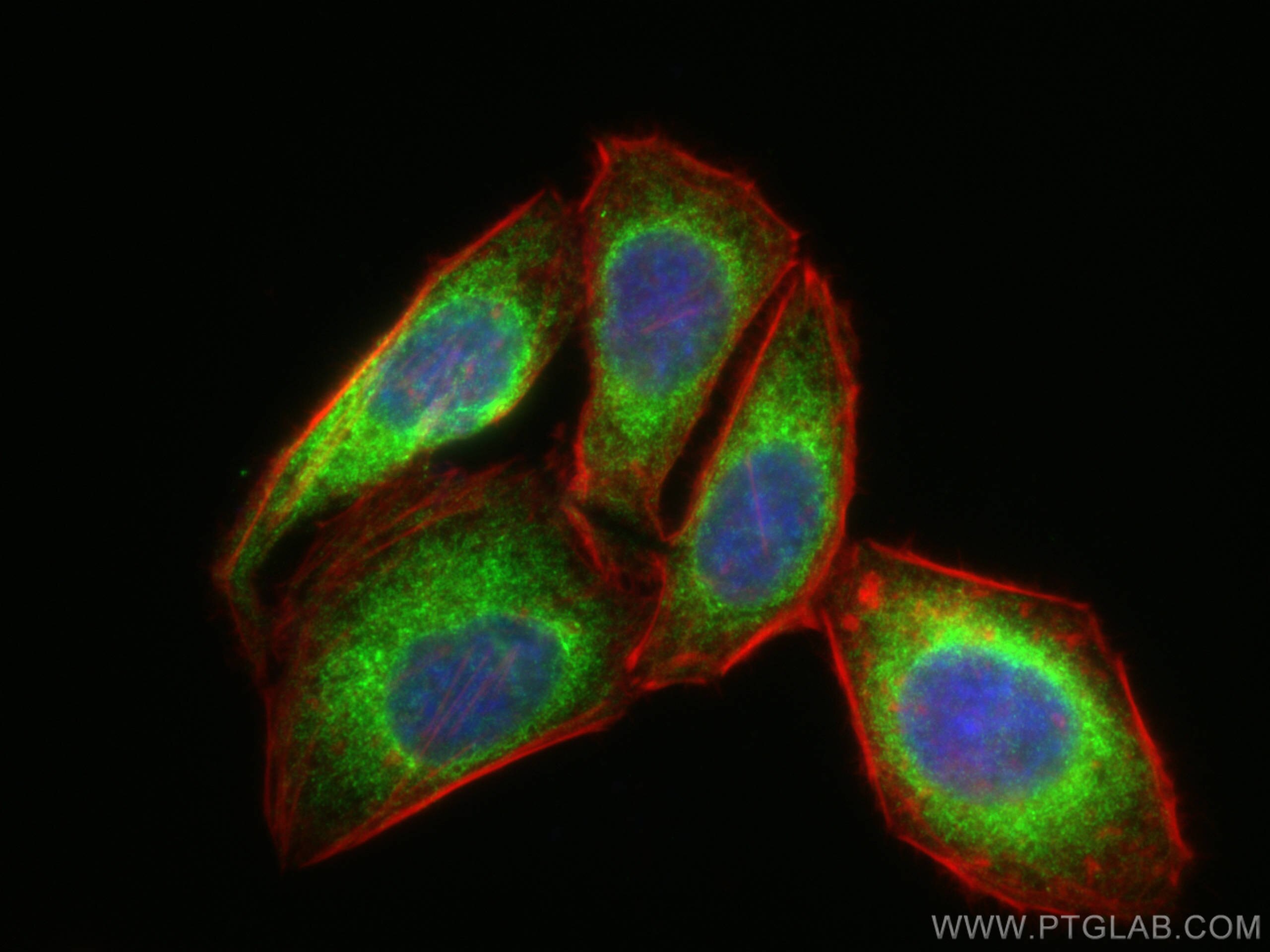 Immunofluorescence (IF) / fluorescent staining of HepG2 cells using calreticulin Polyclonal antibody (27298-1-AP)