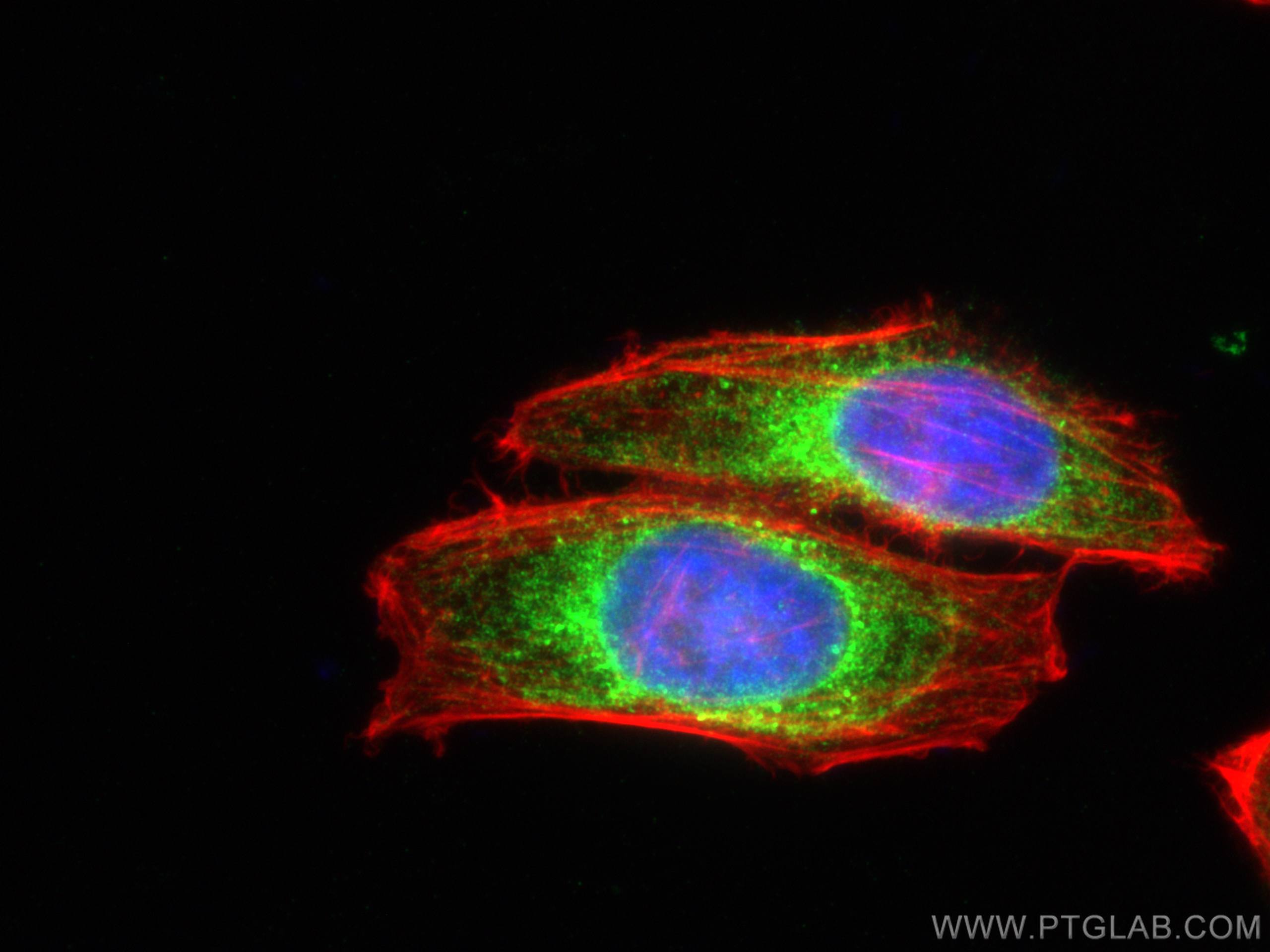 Immunofluorescence (IF) / fluorescent staining of HepG2 cells using calreticulin Polyclonal antibody (27298-1-AP)