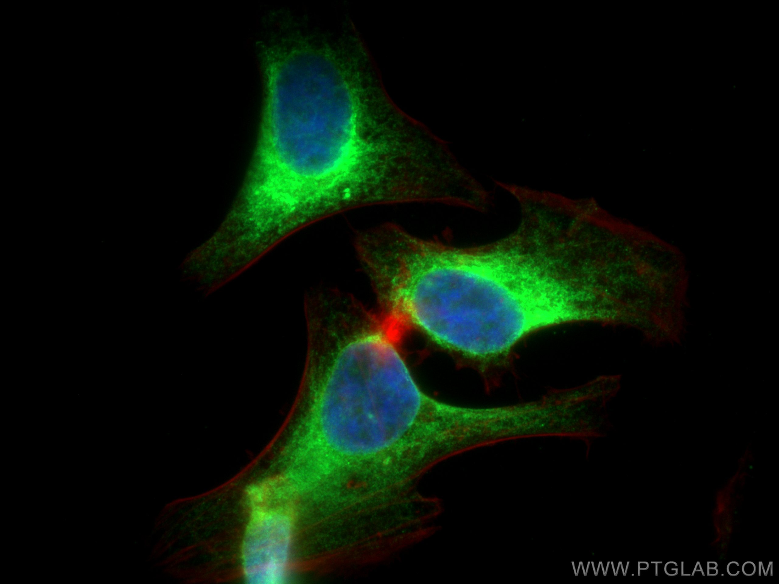 IF Staining of HeLa using 27298-1-AP