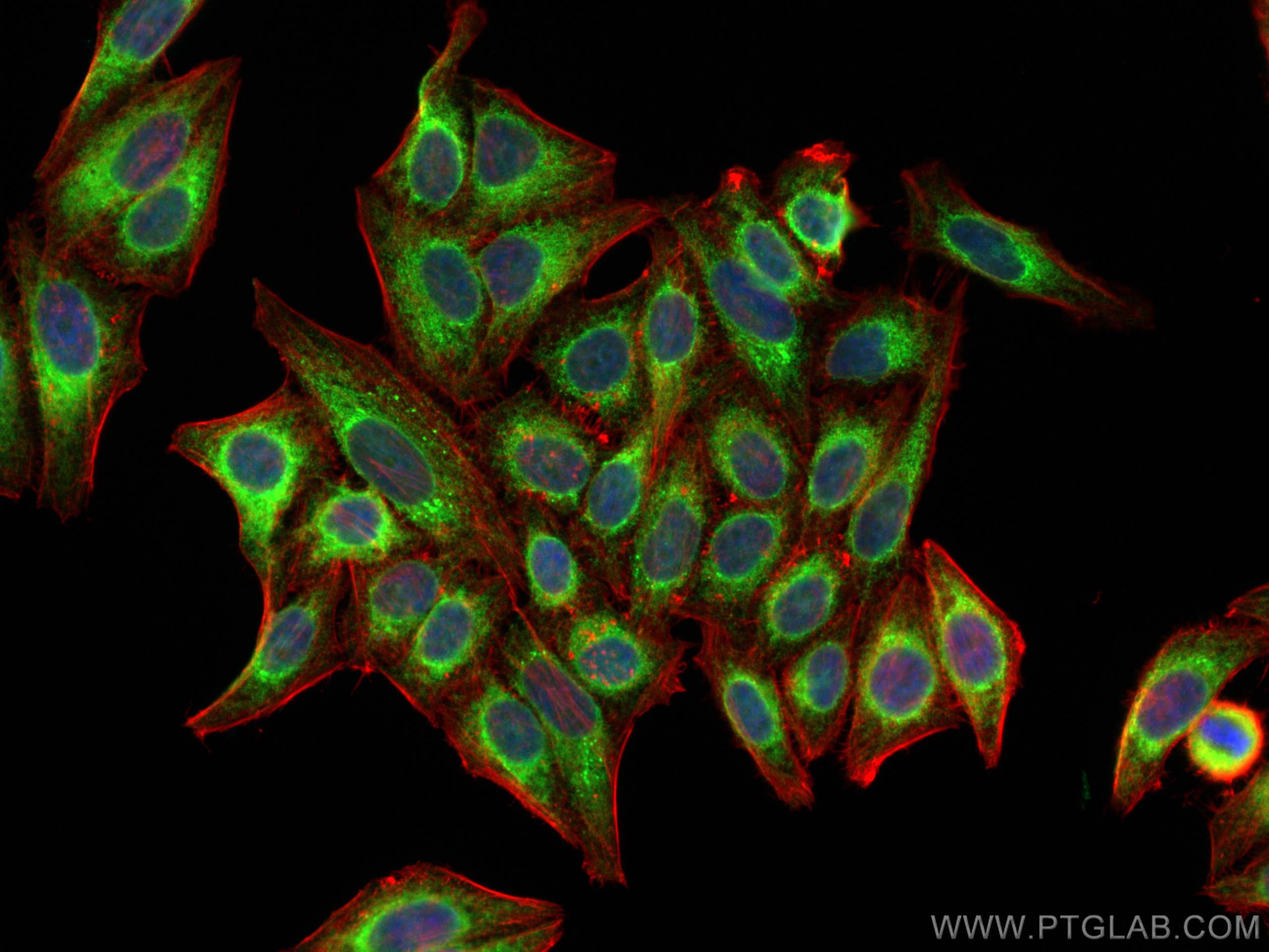 Immunofluorescence (IF) / fluorescent staining of HepG2 cells using calreticulin Polyclonal antibody (27298-1-AP)