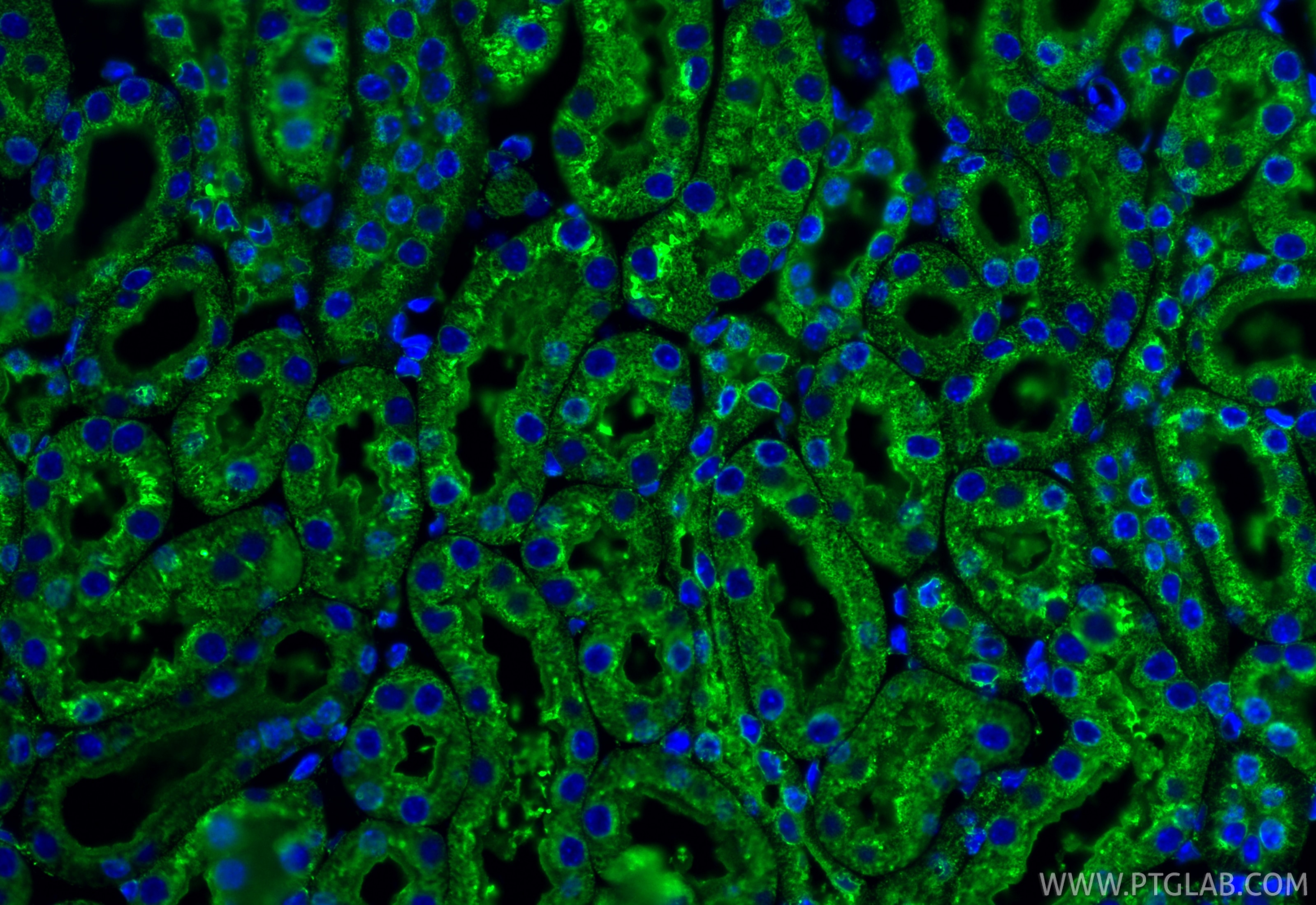 Immunofluorescence (IF) / fluorescent staining of mouse kidney tissue using calreticulin Polyclonal antibody (27298-1-AP)