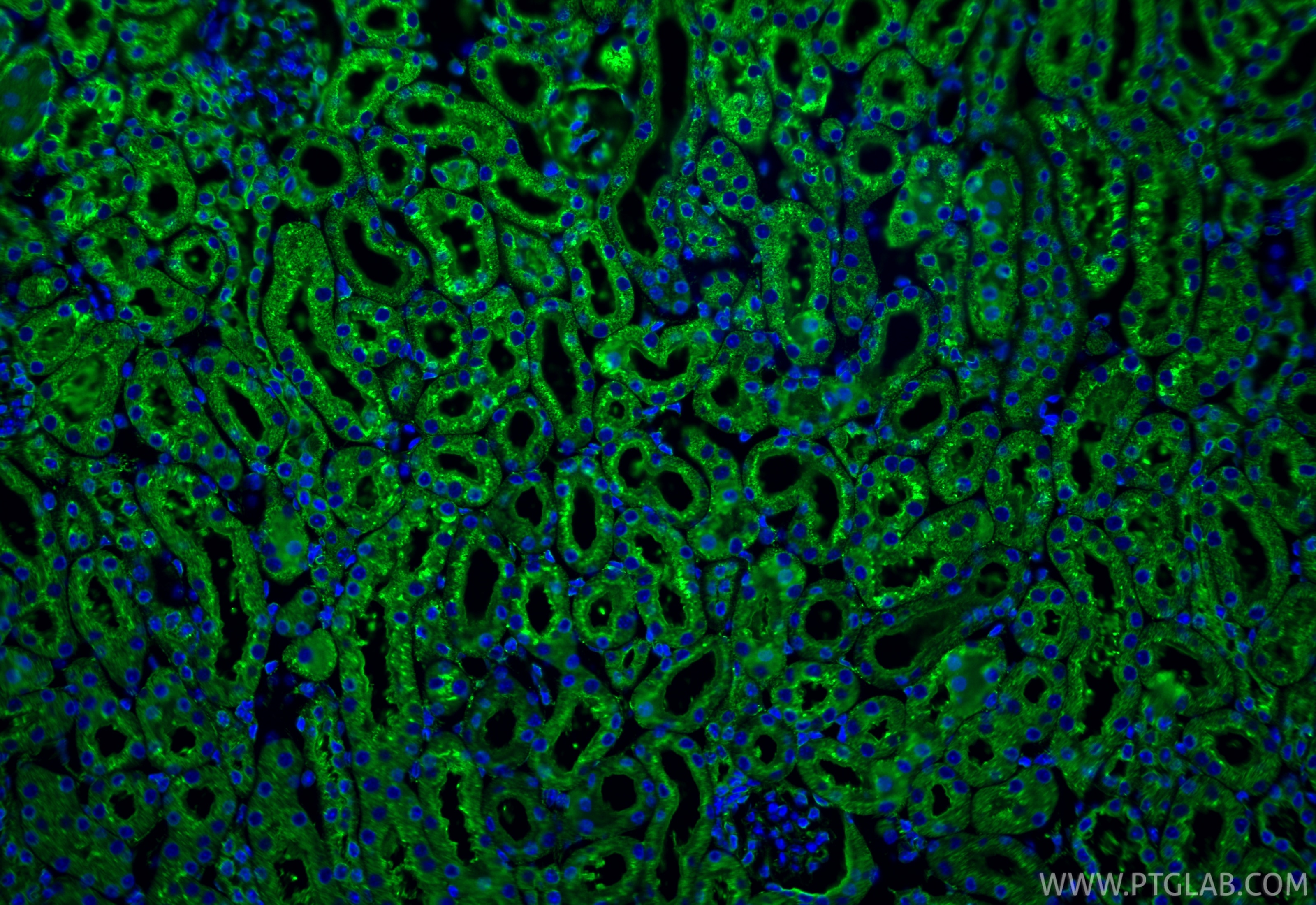 Immunofluorescence (IF) / fluorescent staining of mouse kidney tissue using calreticulin Polyclonal antibody (27298-1-AP)