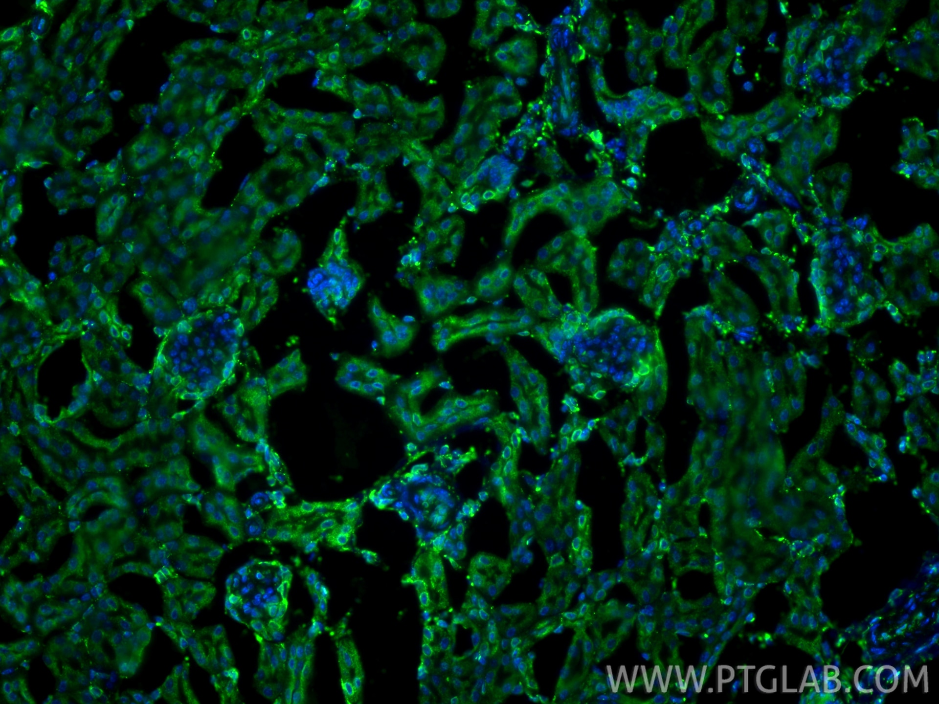 IF Staining of mouse kidney using 27298-1-AP Immunofluorescence (IF) / fluorescent staining of mouse kidney tissue using calreticulin Polyclonal antibody (27298-1-AP)