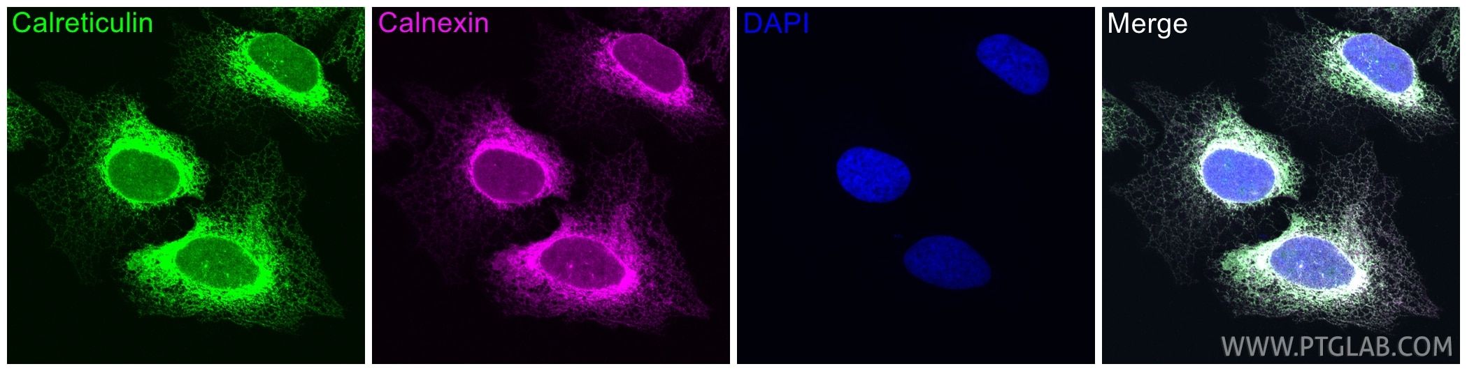 IF Staining of U2OS using 27298-1-AP Immunofluorescence (IF) / fluorescent staining of U2OS cells using calreticulin Polyclonal antibody (27298-1-AP)