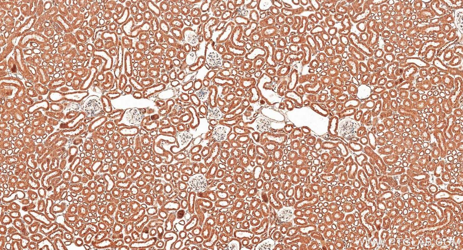 Immunohistochemistry (IHC) staining of mouse kidney tissue using calreticulin Polyclonal antibody (27298-1-AP)