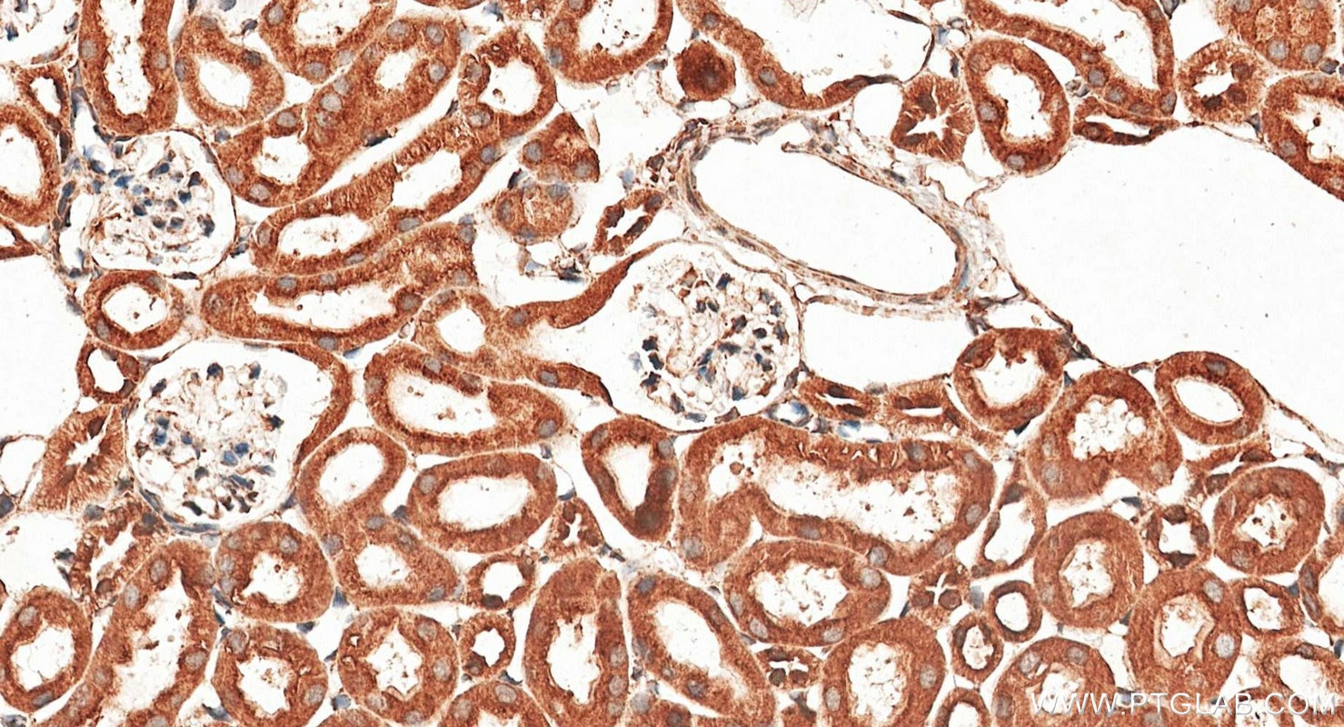 Immunohistochemistry (IHC) staining of mouse kidney tissue using calreticulin Polyclonal antibody (27298-1-AP)