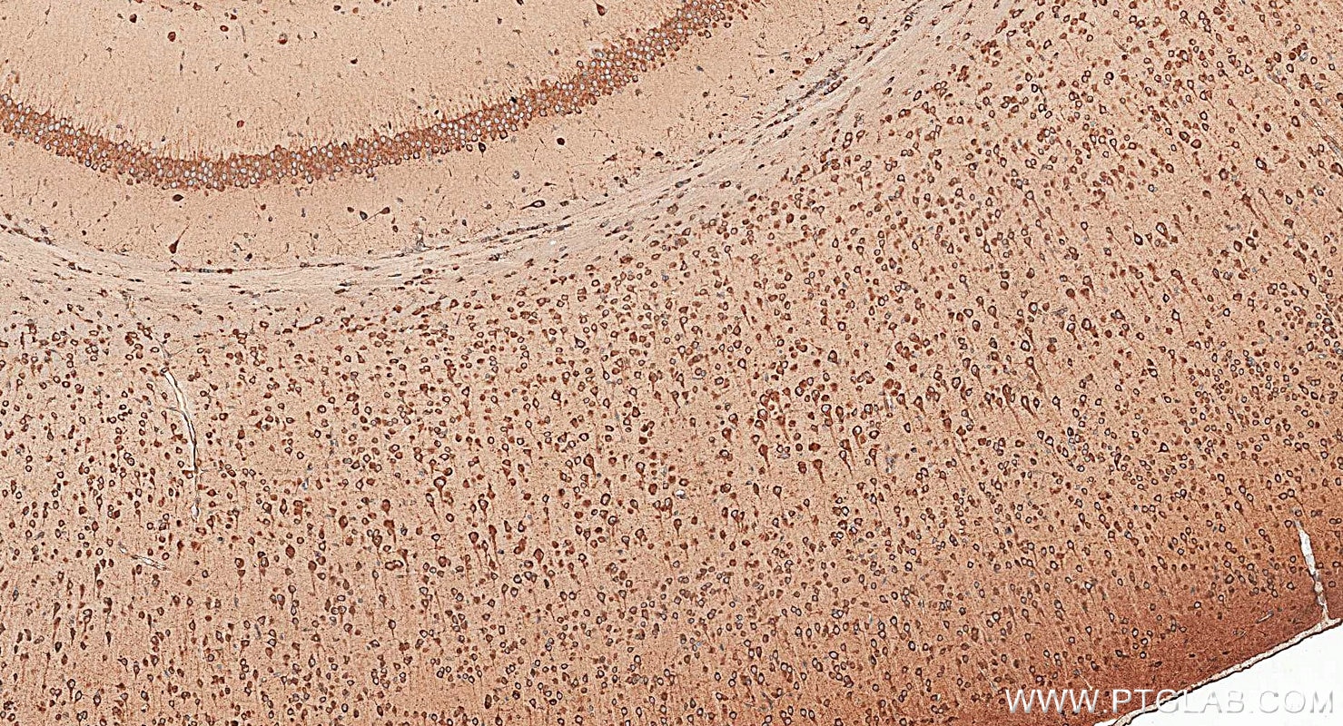 Immunohistochemistry (IHC) staining of mouse brain tissue using calreticulin Polyclonal antibody (27298-1-AP)