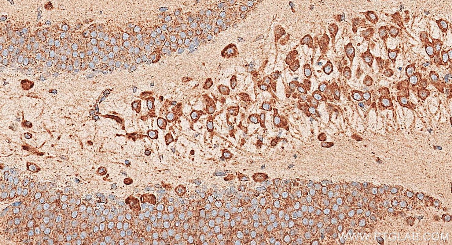 Immunohistochemistry (IHC) staining of mouse brain tissue using calreticulin Polyclonal antibody (27298-1-AP)