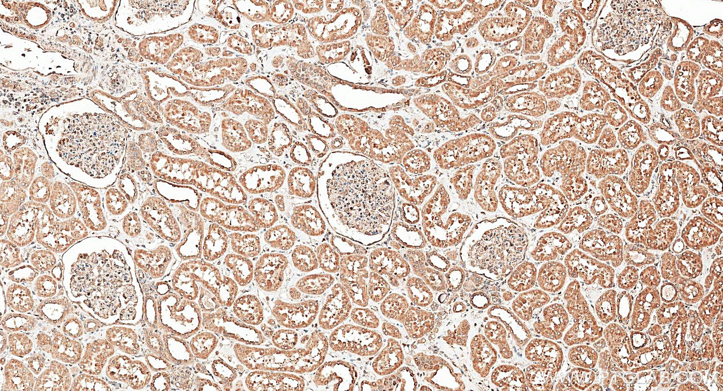 IHC staining of human kidney using 27298-1-AP Immunohistochemistry (IHC) staining of human kidney tissue using calreticulin Polyclonal antibody (27298-1-AP)