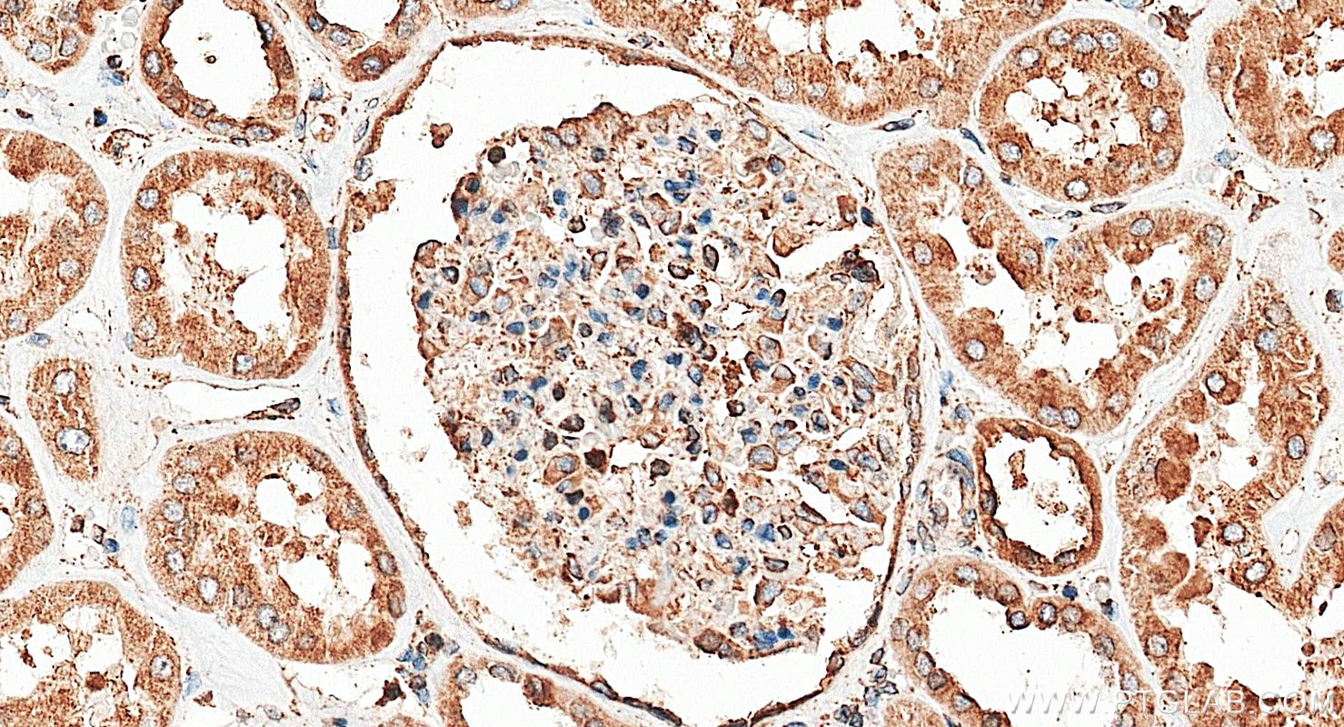 Immunohistochemistry (IHC) staining of human kidney tissue using calreticulin Polyclonal antibody (27298-1-AP)