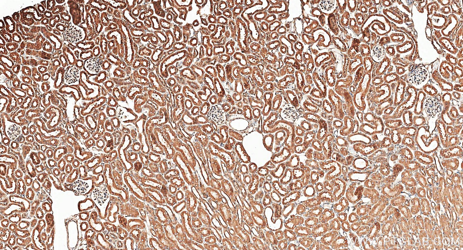 Immunohistochemistry (IHC) staining of mouse kidney tissue using calreticulin Polyclonal antibody (27298-1-AP)