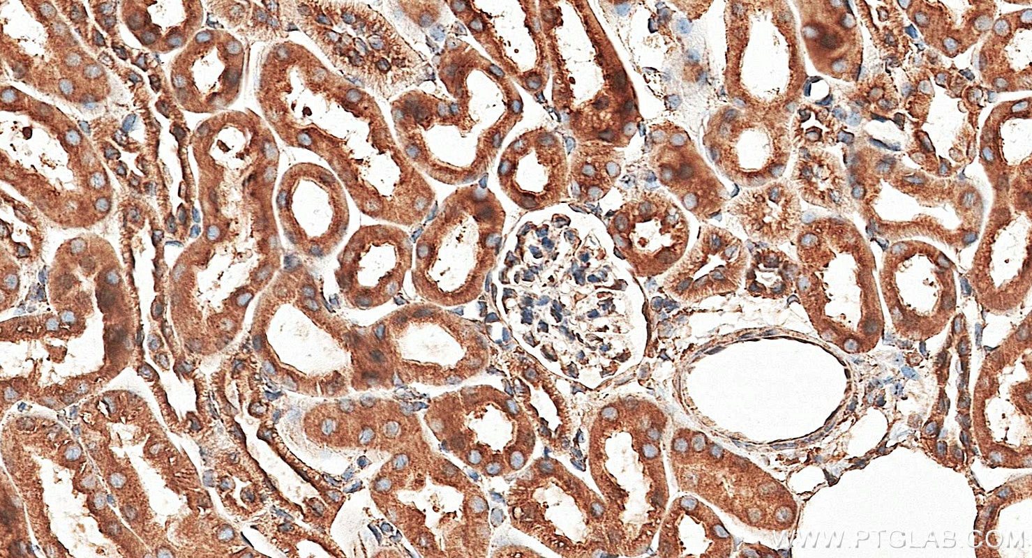 Immunohistochemistry (IHC) staining of mouse kidney tissue using calreticulin Polyclonal antibody (27298-1-AP)
