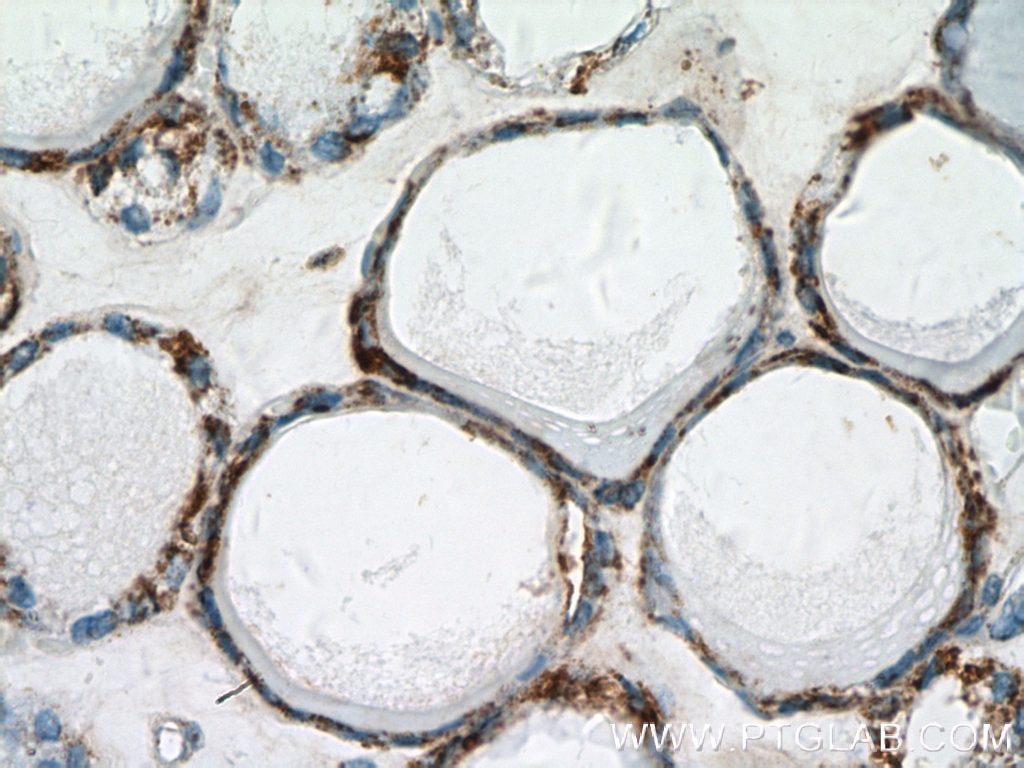 Immunohistochemistry (IHC) staining of human thyroid tissue using calreticulin Polyclonal antibody (27298-1-AP)