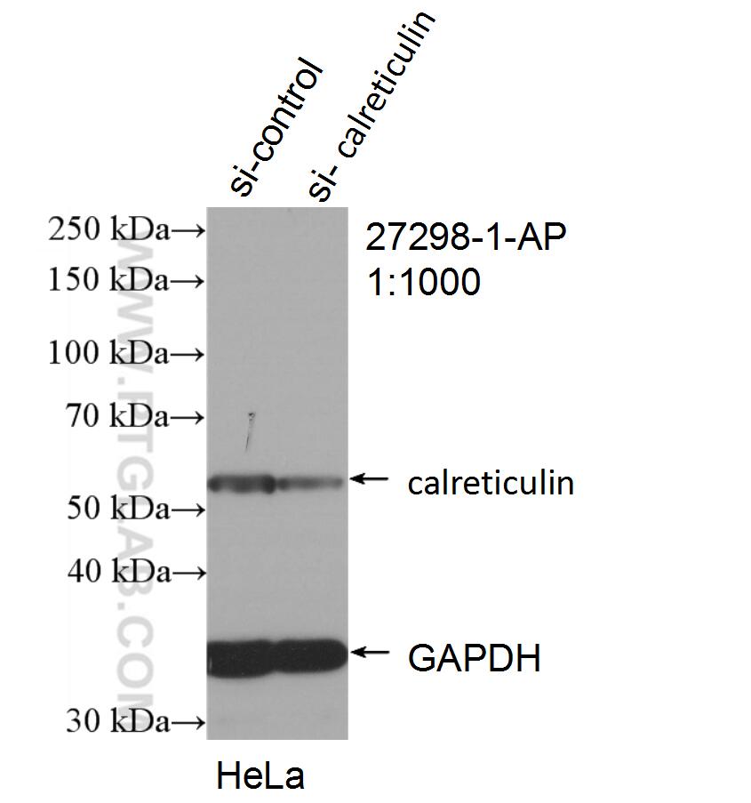 WB analysis of HeLa using 27298-1-AP