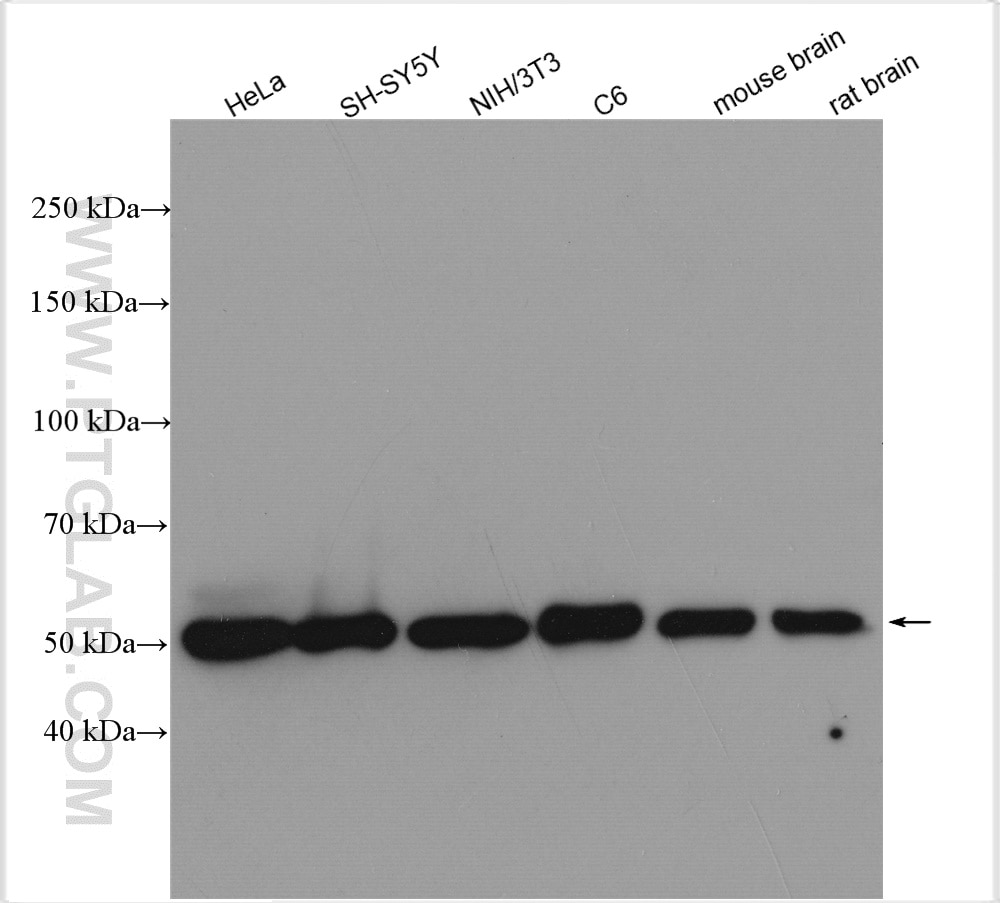 Western Blot (WB) analysis of various lysates using calreticulin Polyclonal antibody (27298-1-AP)