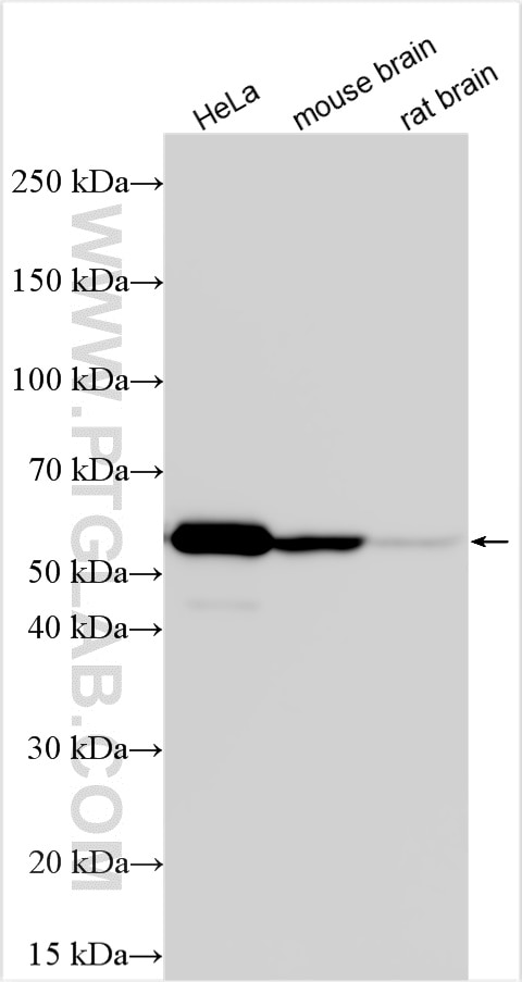 Western Blot (WB) analysis of various lysates using calreticulin Polyclonal antibody (27298-1-AP)