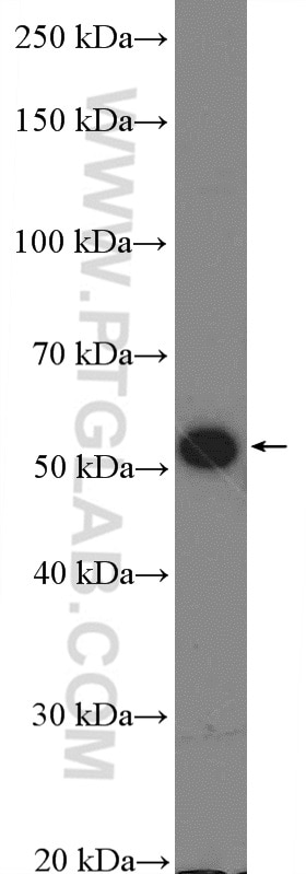 calreticulin Polyclonal antibody