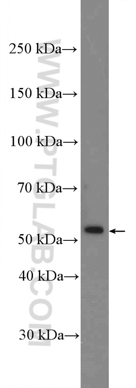 Western Blot (WB) analysis of mouse skeletal muscle tissue using calreticulin Polyclonal antibody (27298-1-AP)