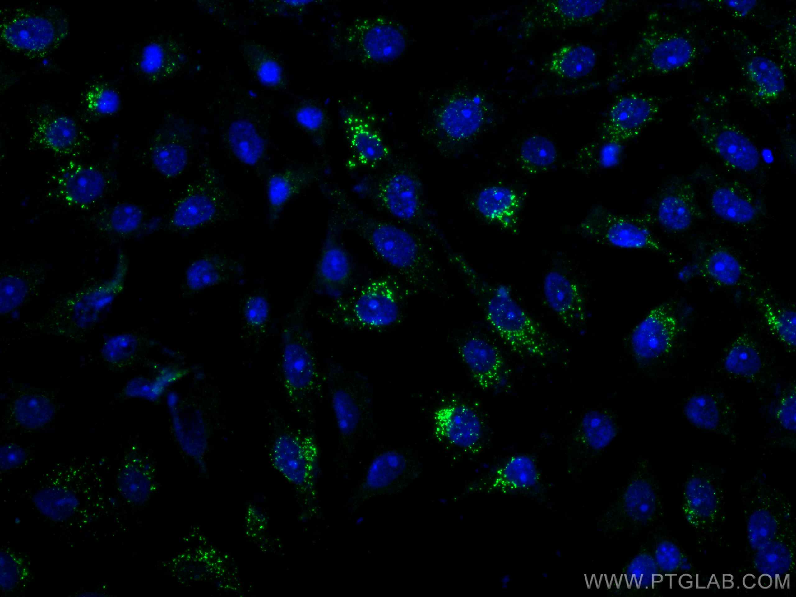 Immunofluorescence (IF) / fluorescent staining of SH-SY5Y cells using Calretinin Monoclonal antibody (66496-1-Ig)